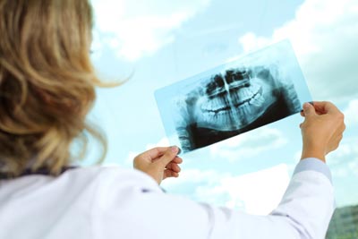 Abogados de Negligencia Dental